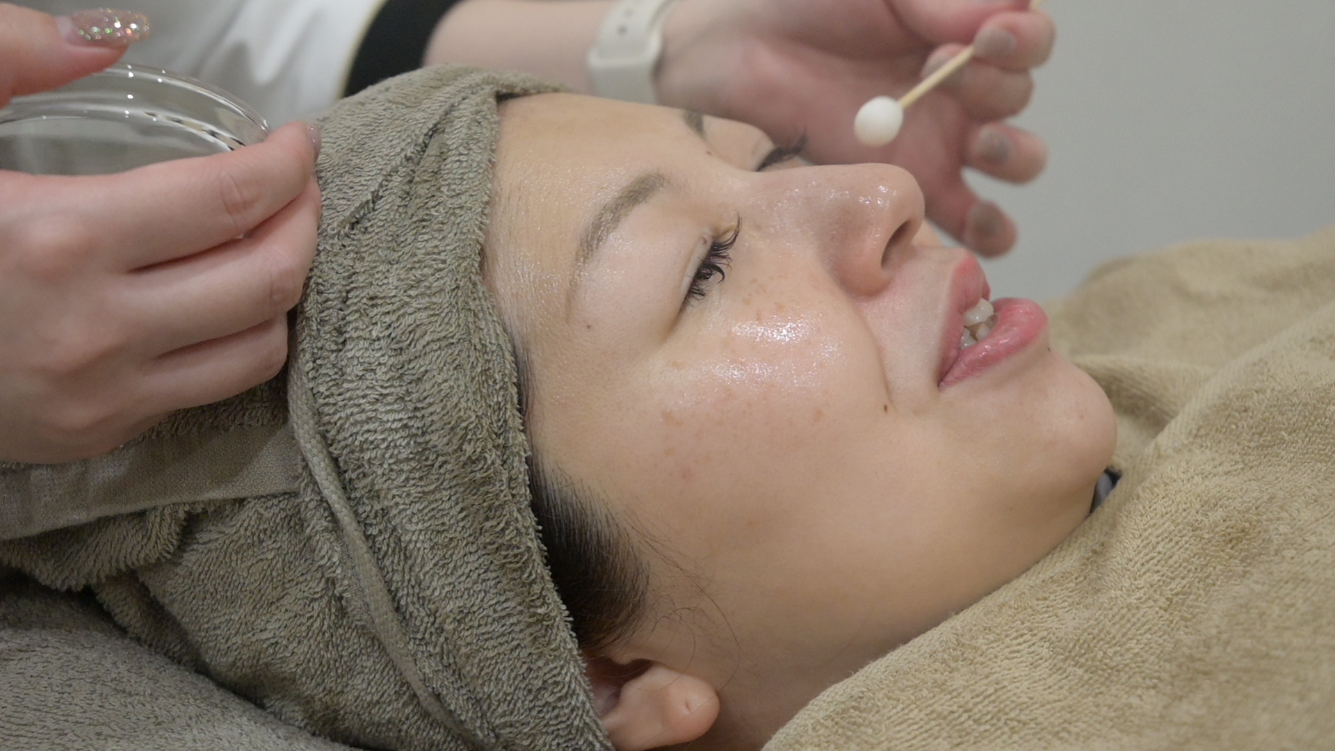 ララピール 施術